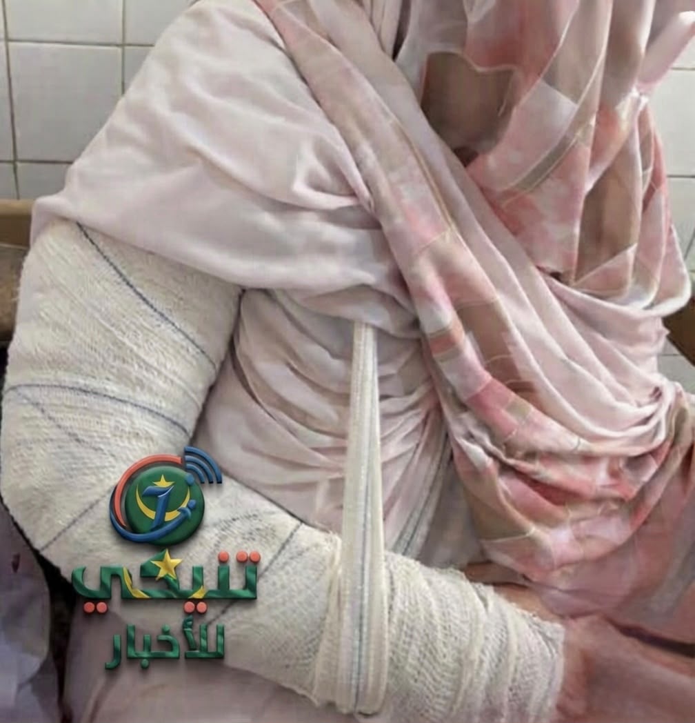 توقيف شاب متهم بالاعتداء على ممرضة داخل مركز الاستطباب الوطني